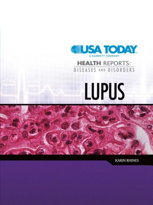 Title details for Lupus by Karin Rhines - Available